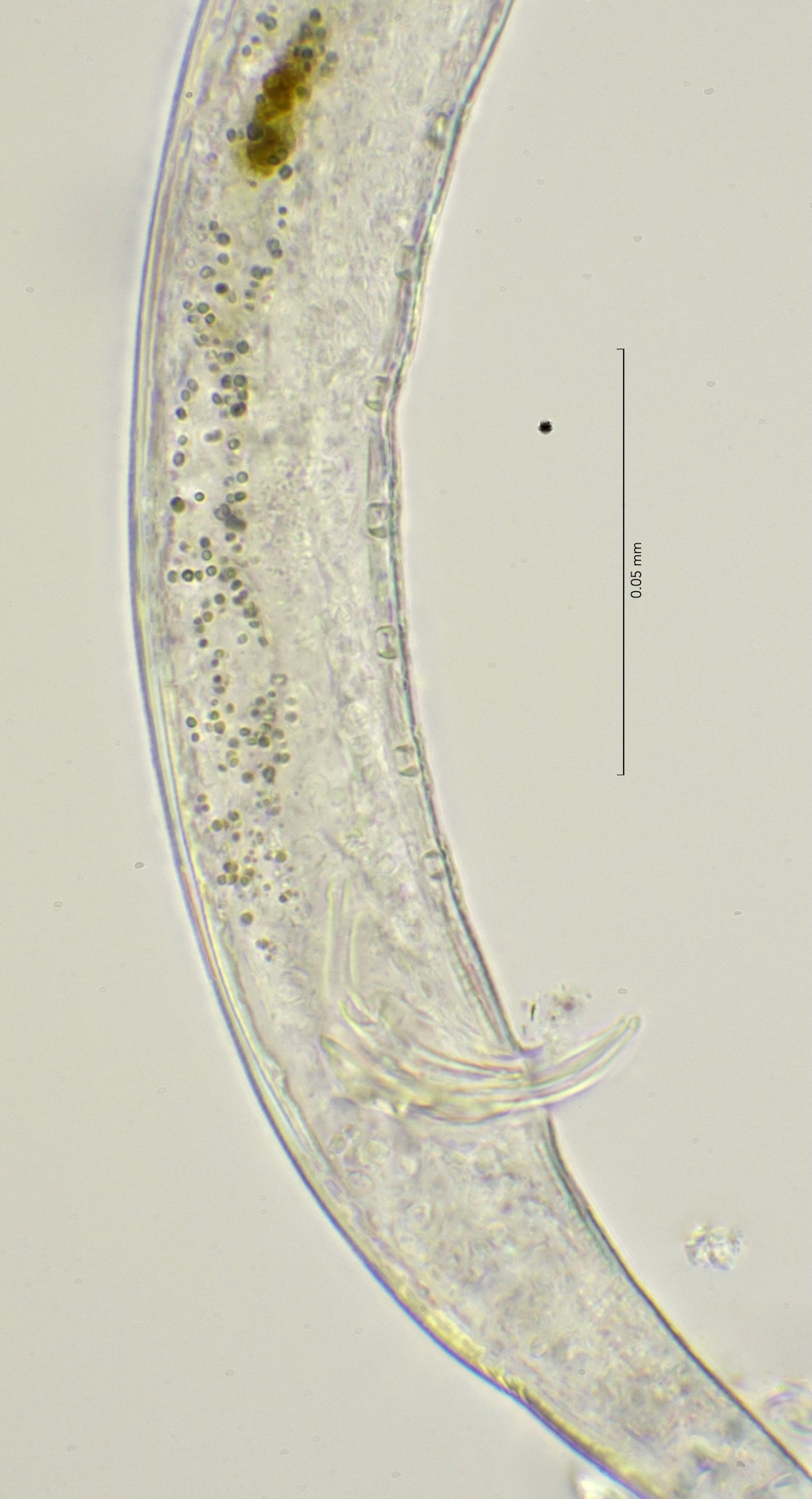 cloaca region, 100x stack