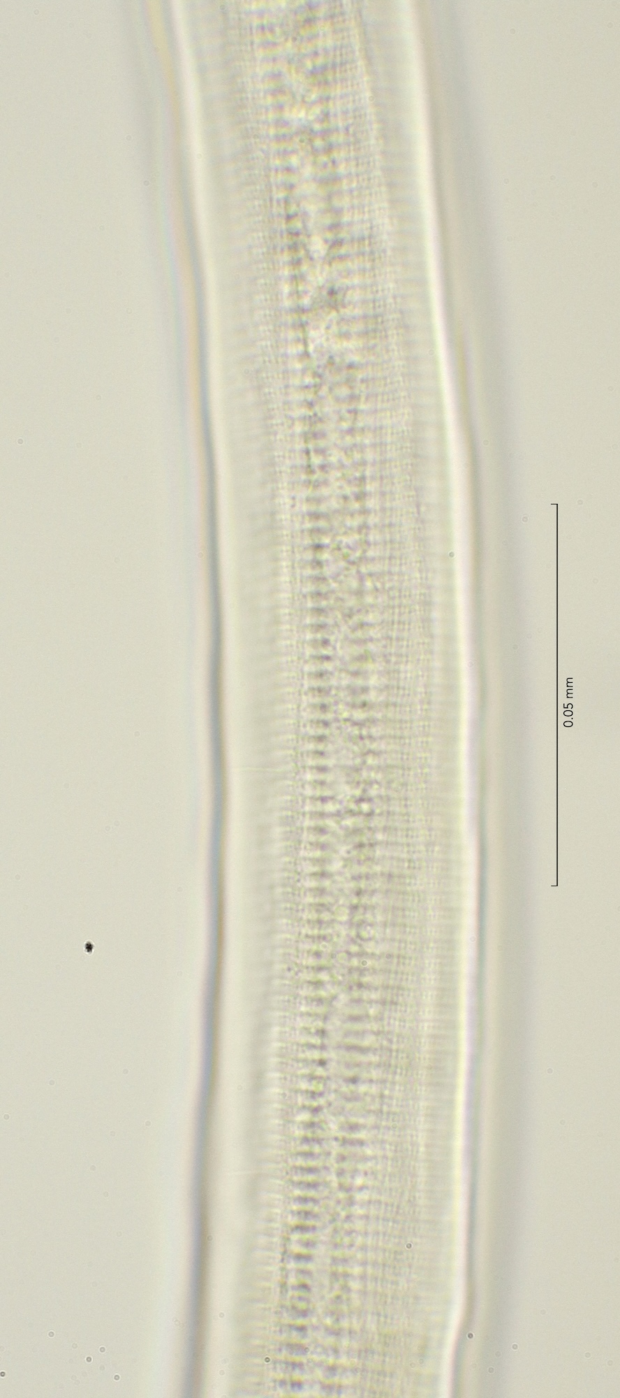 cuticula ornamentation at mid body, 100x