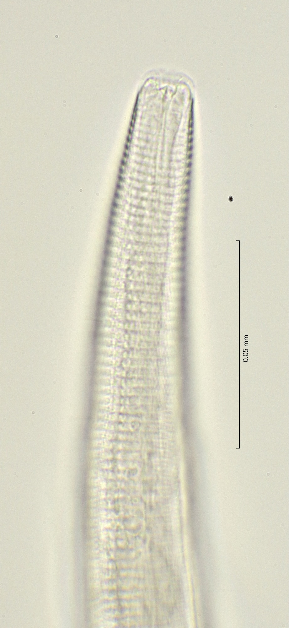 head region with dorsal tooth, 100x