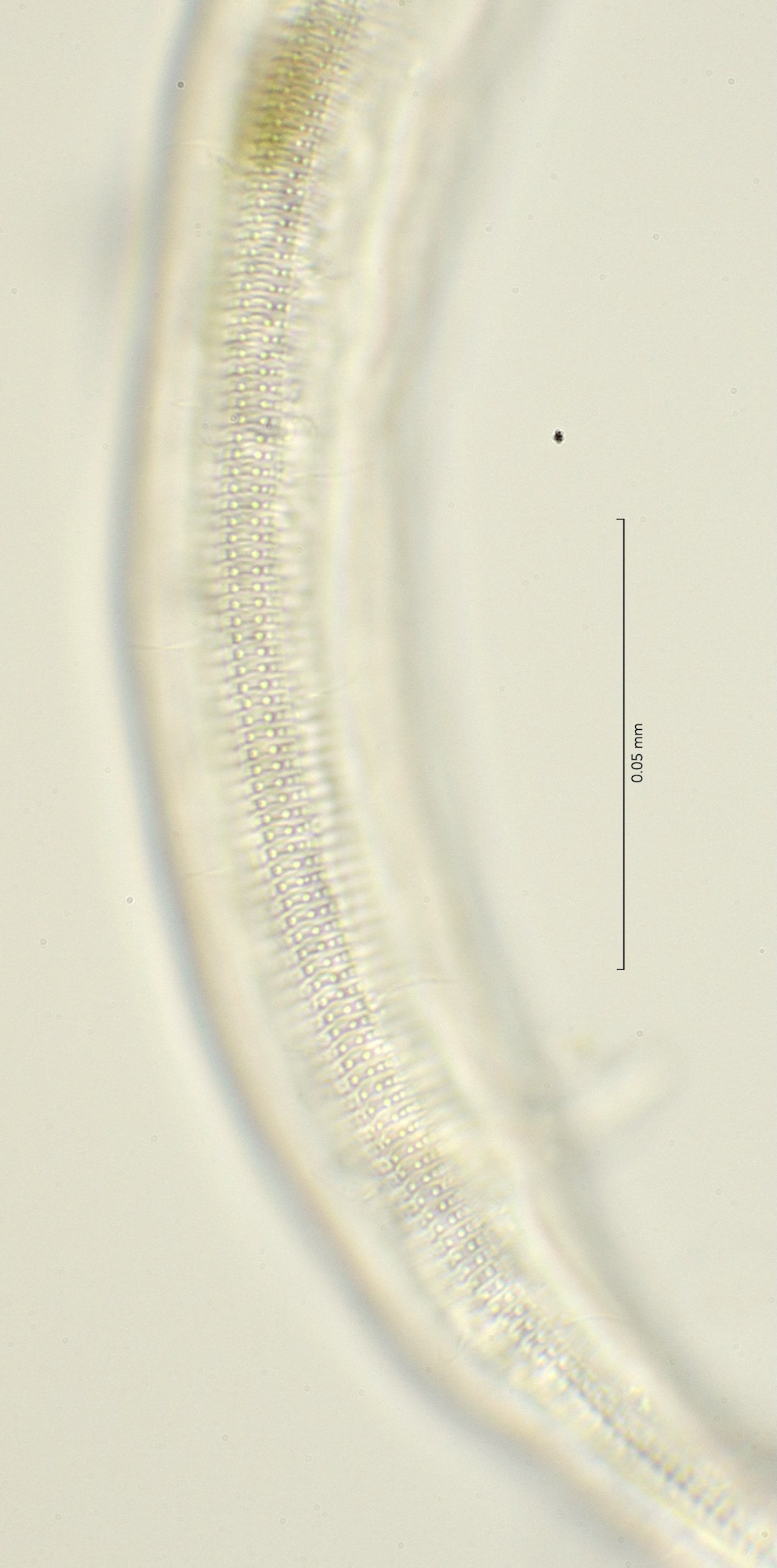 lateral field at cloaca region, 100x