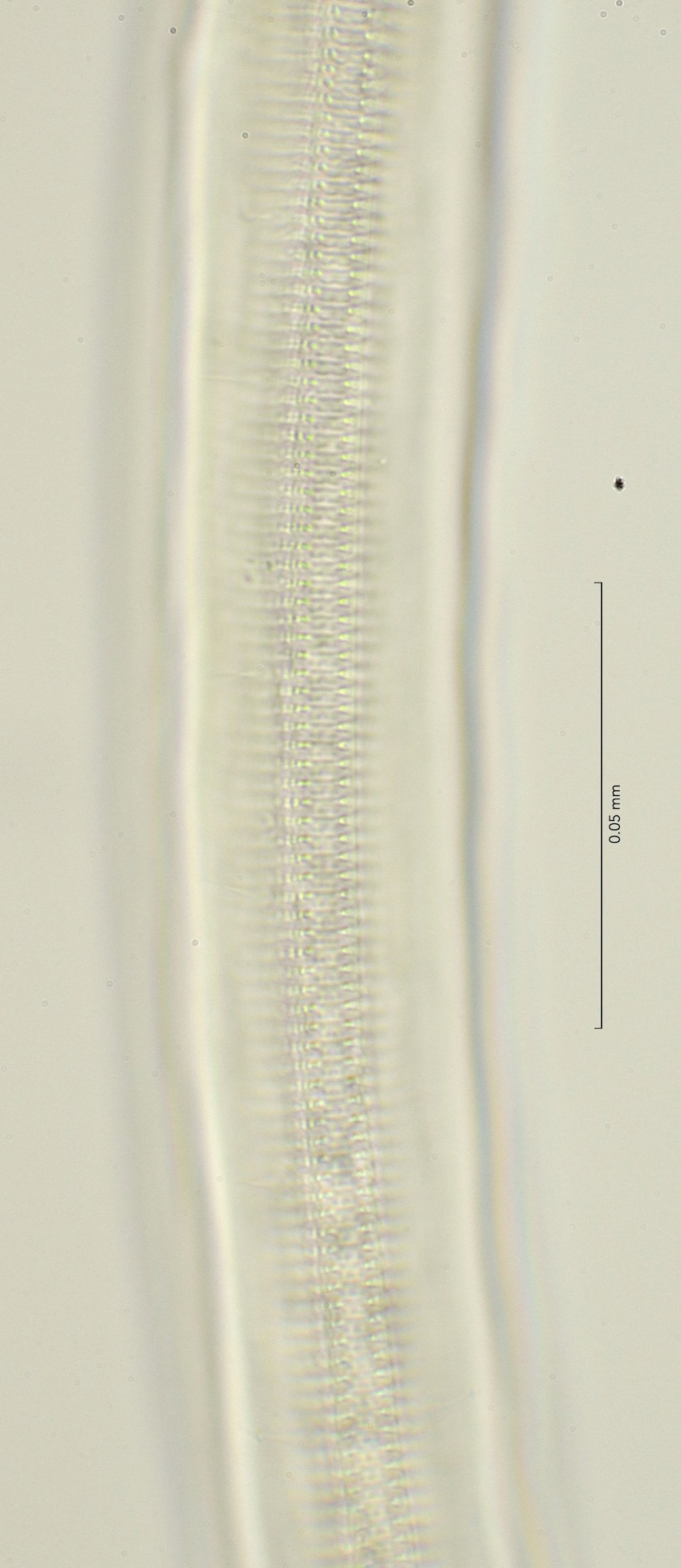 lateral field at mid body, 100x