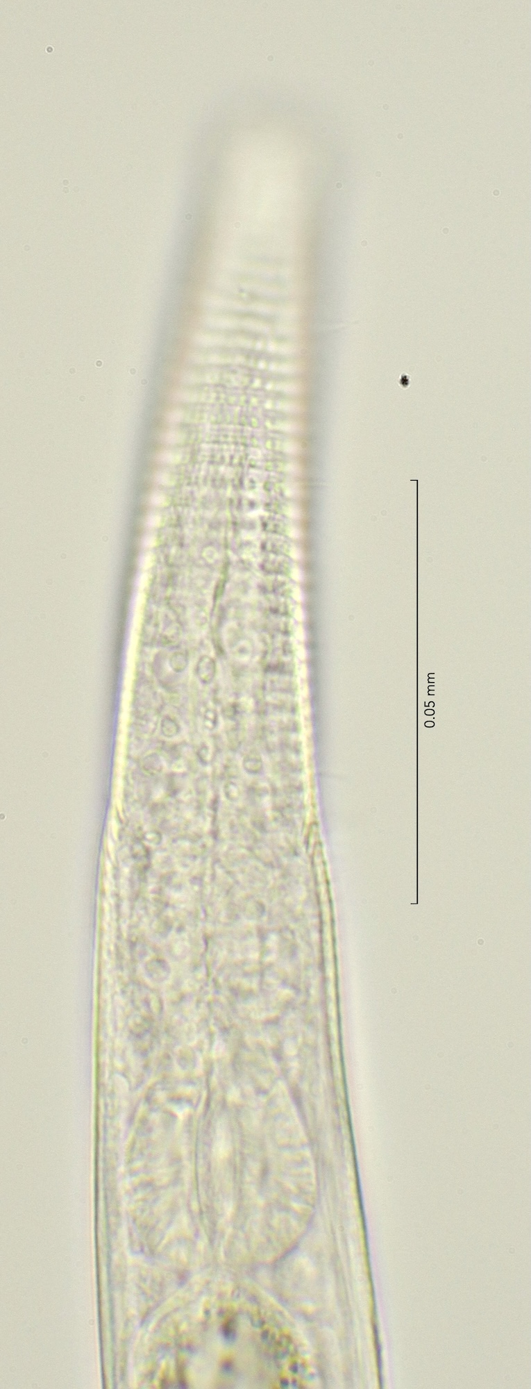 lateral field oesophagus region, 100x