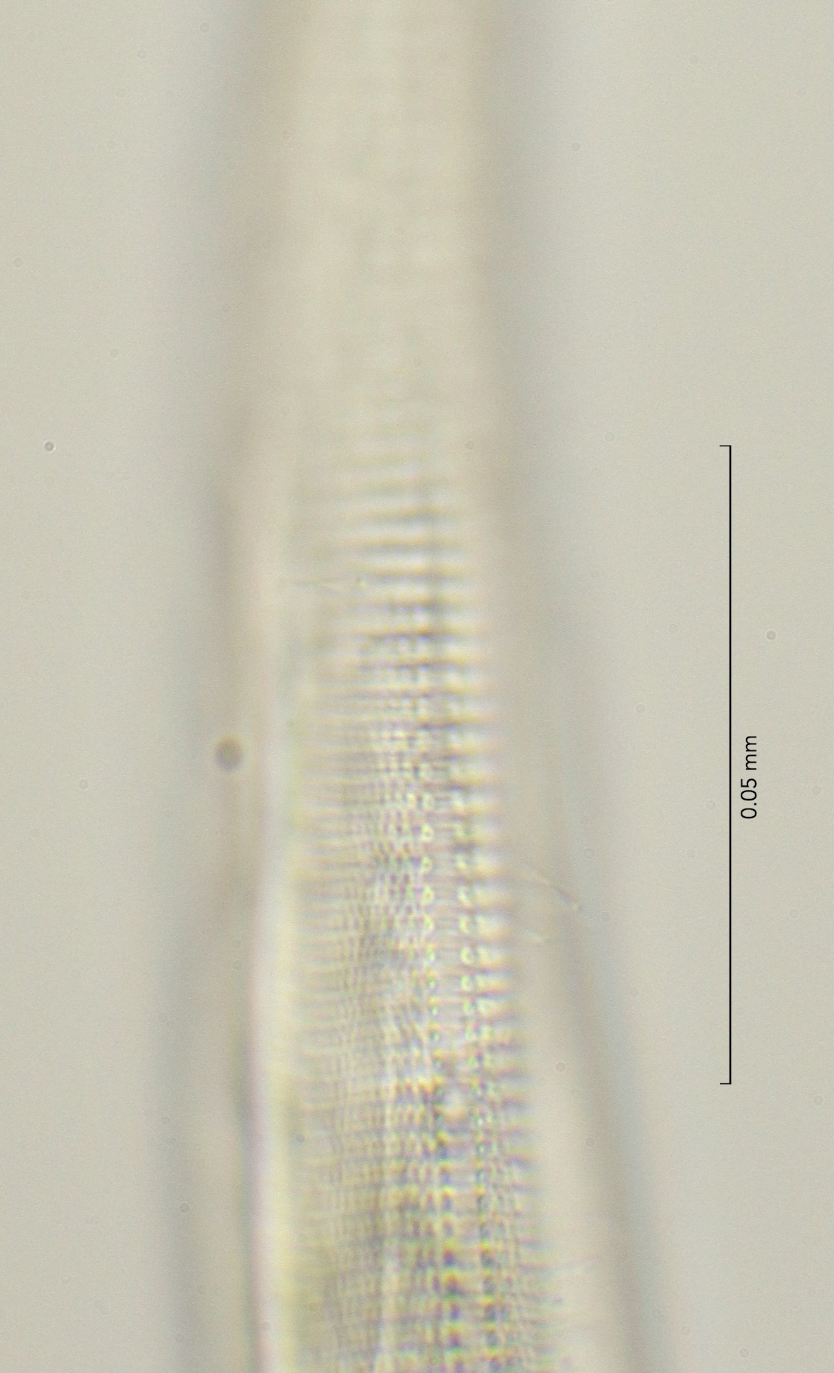 lateral field at oesophagus end, 100x