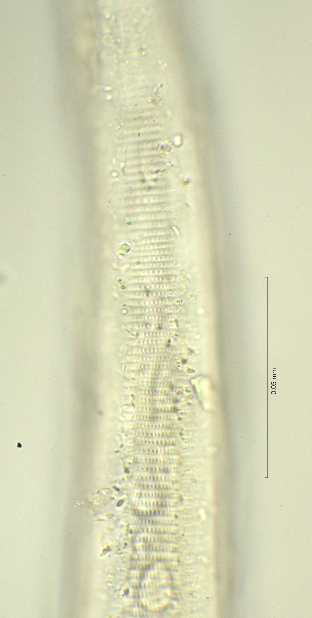 lateral field at oesophagus end, 100x