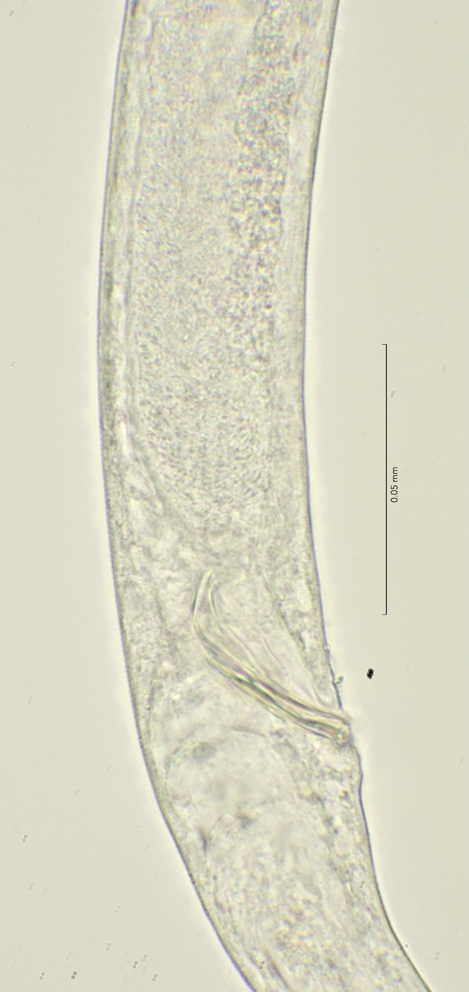 cloaca region, 100x stack