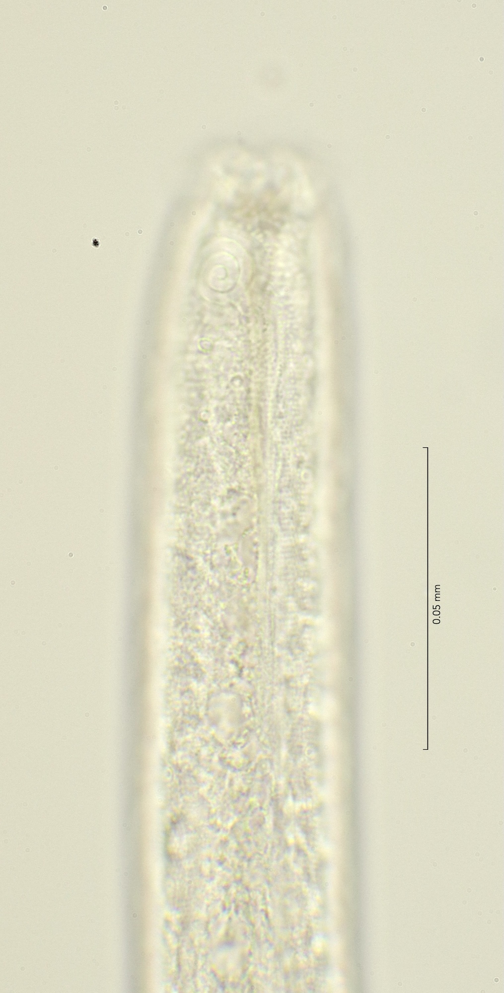 head region with amphid, 100x