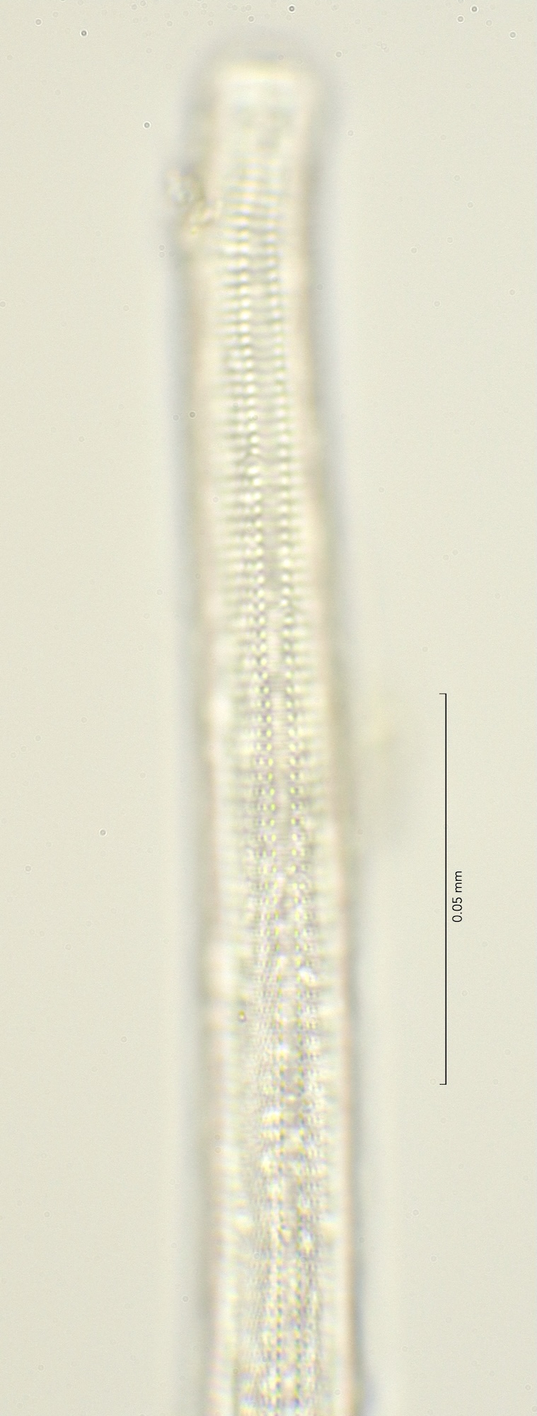 lateral field oesophagus region, 100x