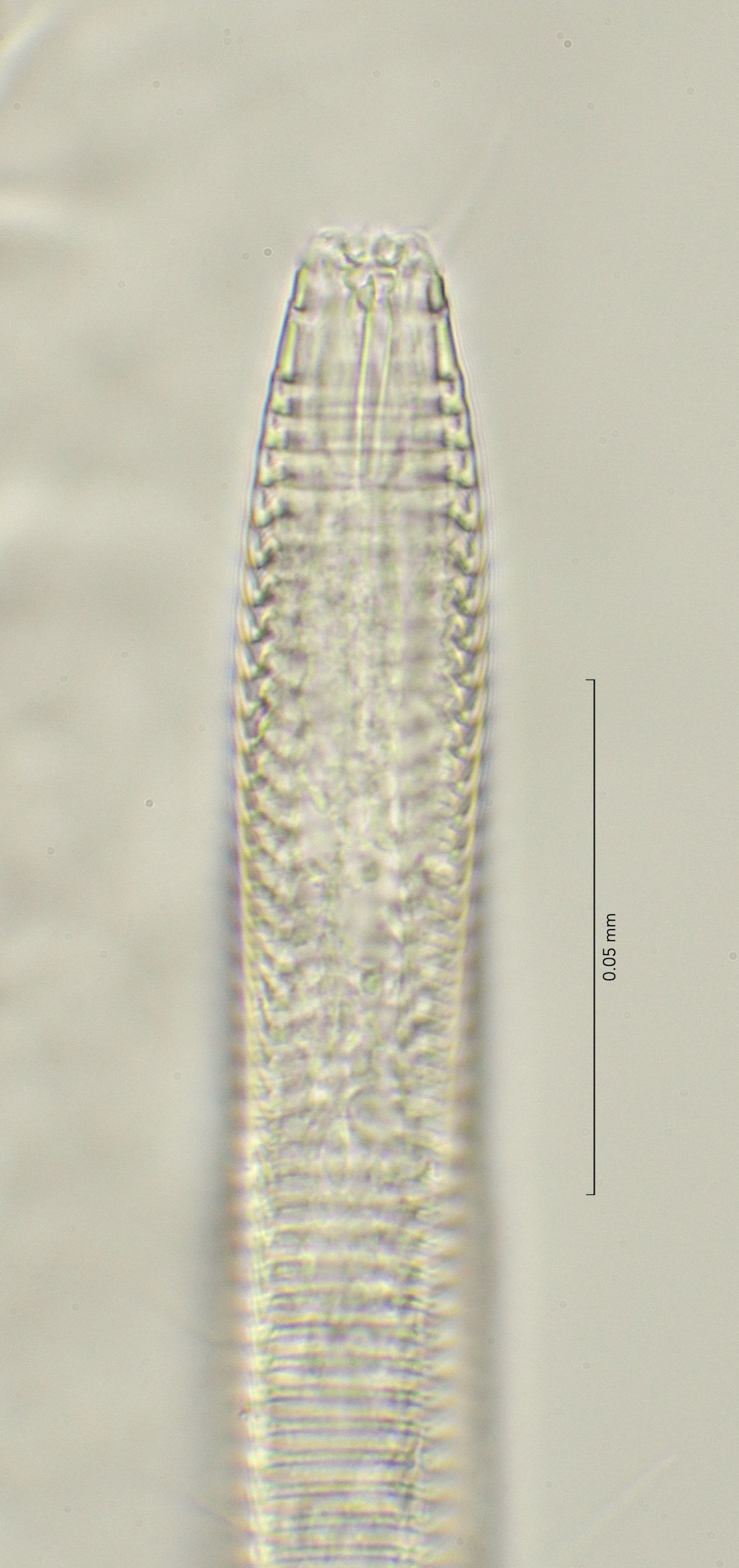 head region with dorsal tooth, 100x