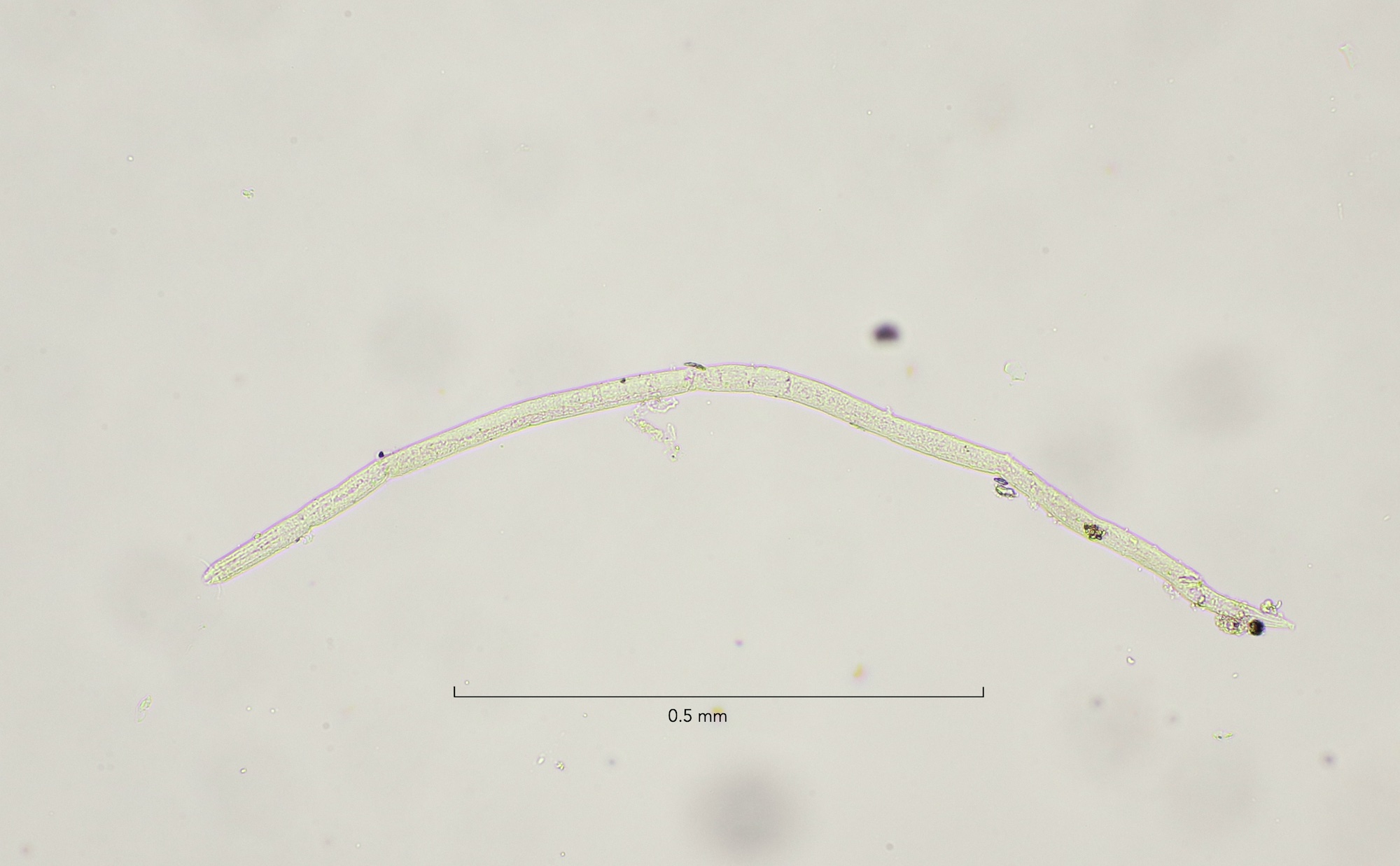 Bathylaimus stenolaimus, male overview 10x objective, Egmond aan Zee 24-4-2021