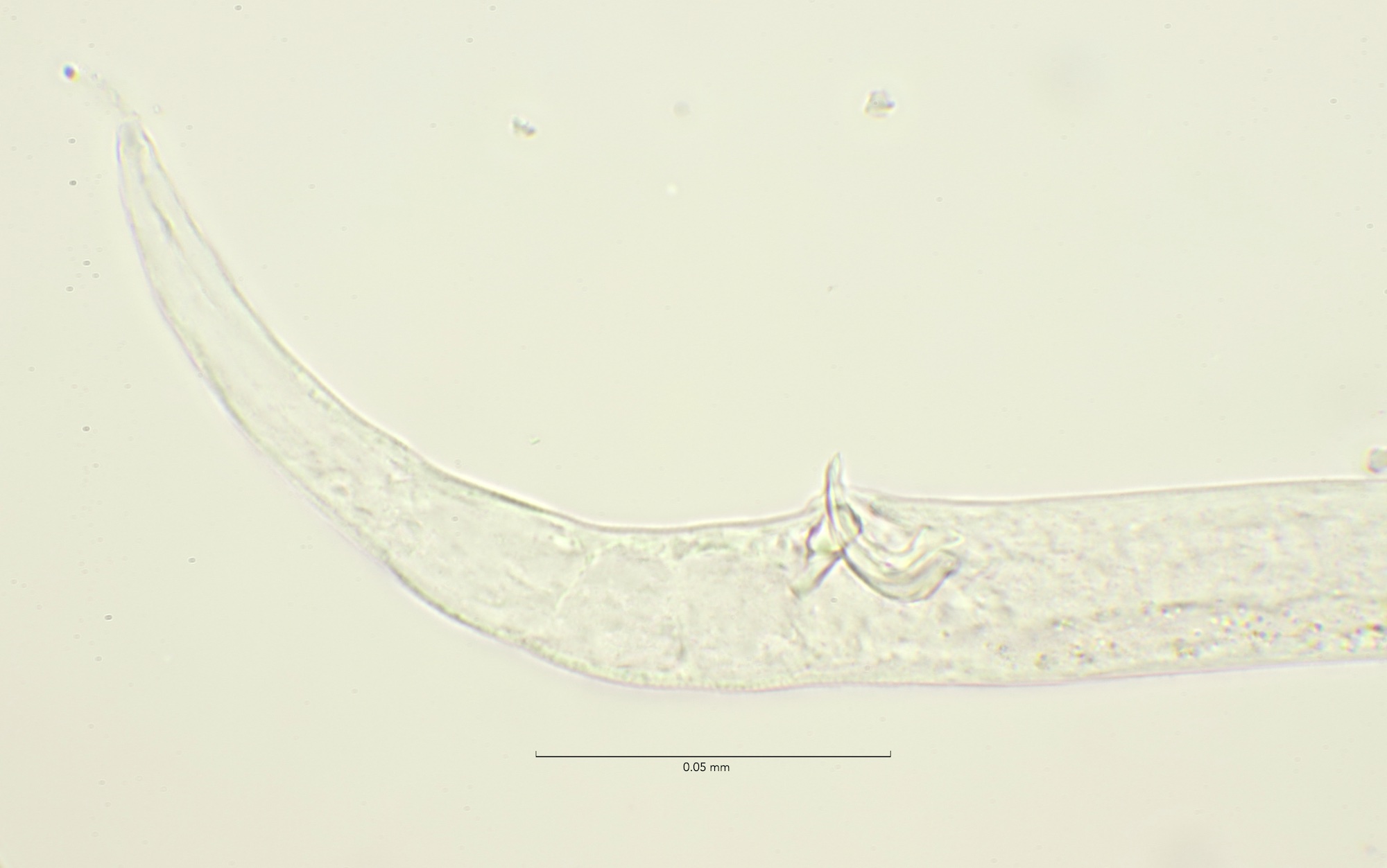 Odontophora longisetosa male, cloaca 100x objective, stack, Egmond aan Zee 21-5-2023