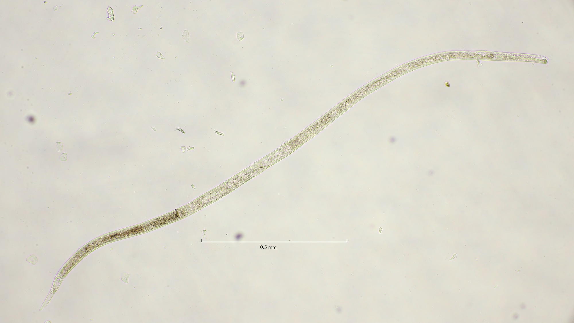 Odontophora longisetosa female, overview 10x objective, Egmond aan Zee 21-5-2023