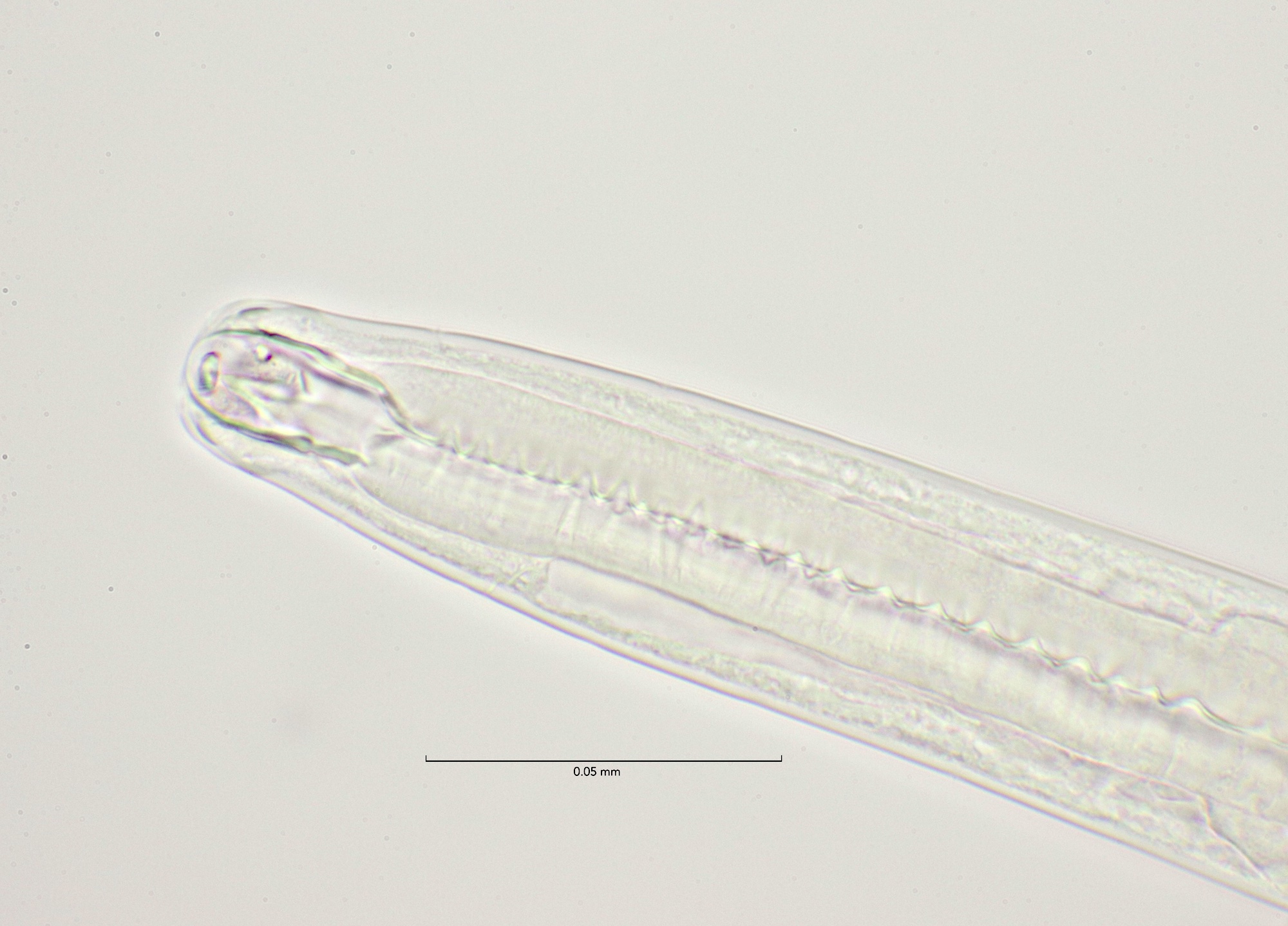 Adoncholaimus thalassophygas, male head 100x objective, Stellendam 23-1-2022