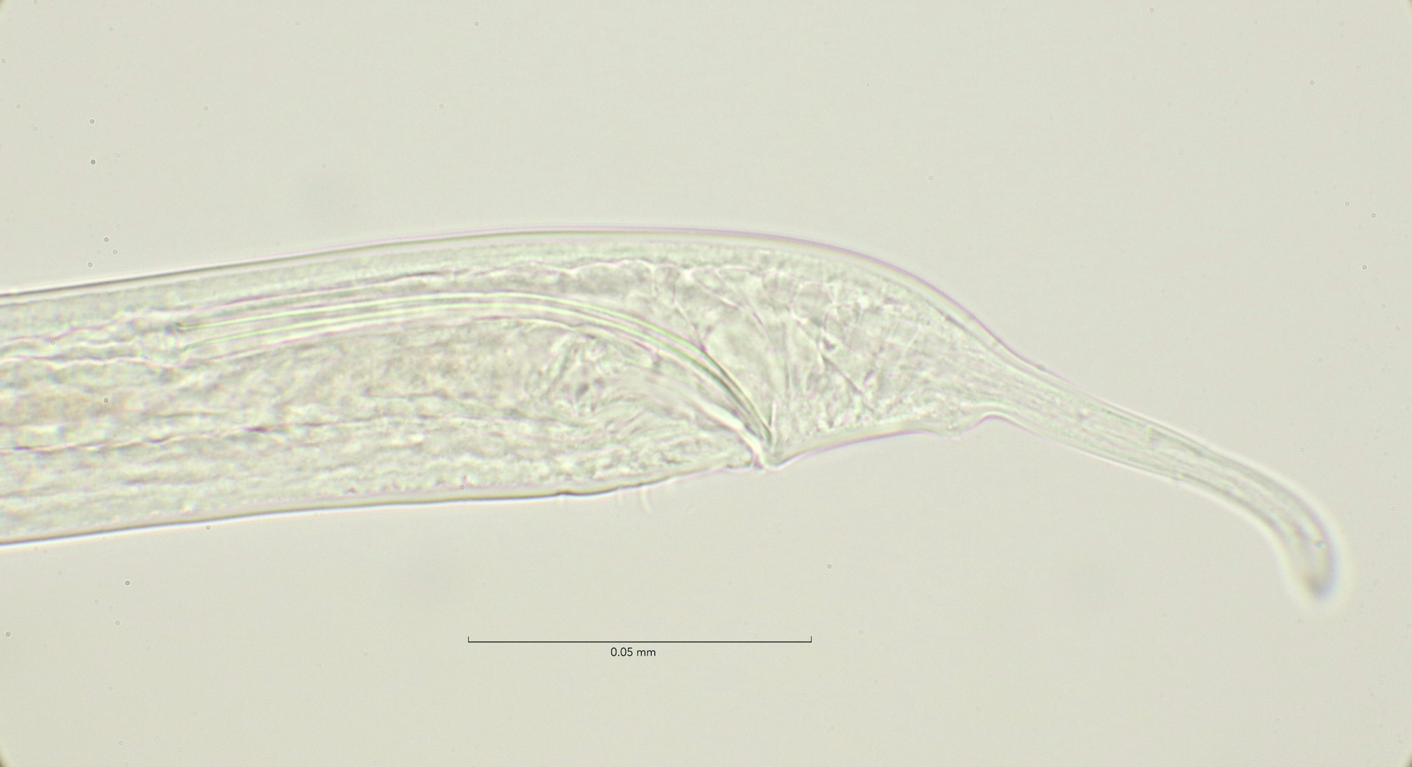 Adoncholaimus thalassophygas, male spicula 100x objective, Stellendam 23-1-2022
