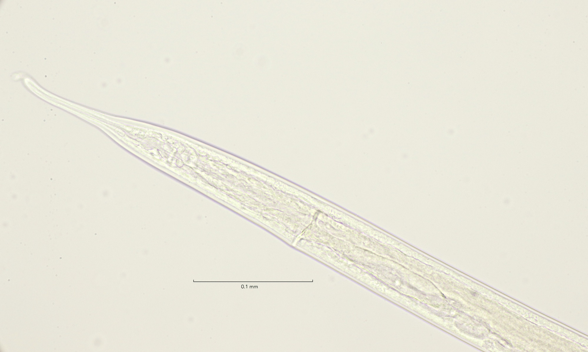 Adoncholaimus thalassophygas, female demannian system dorsal view 40x objective, Stellendam 23-1-2022