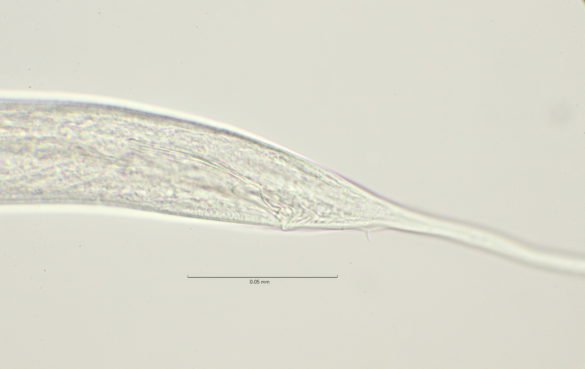 Anoplostoma viviparum, Slikken van Flakkee 9-4-2023 male spicula 100x