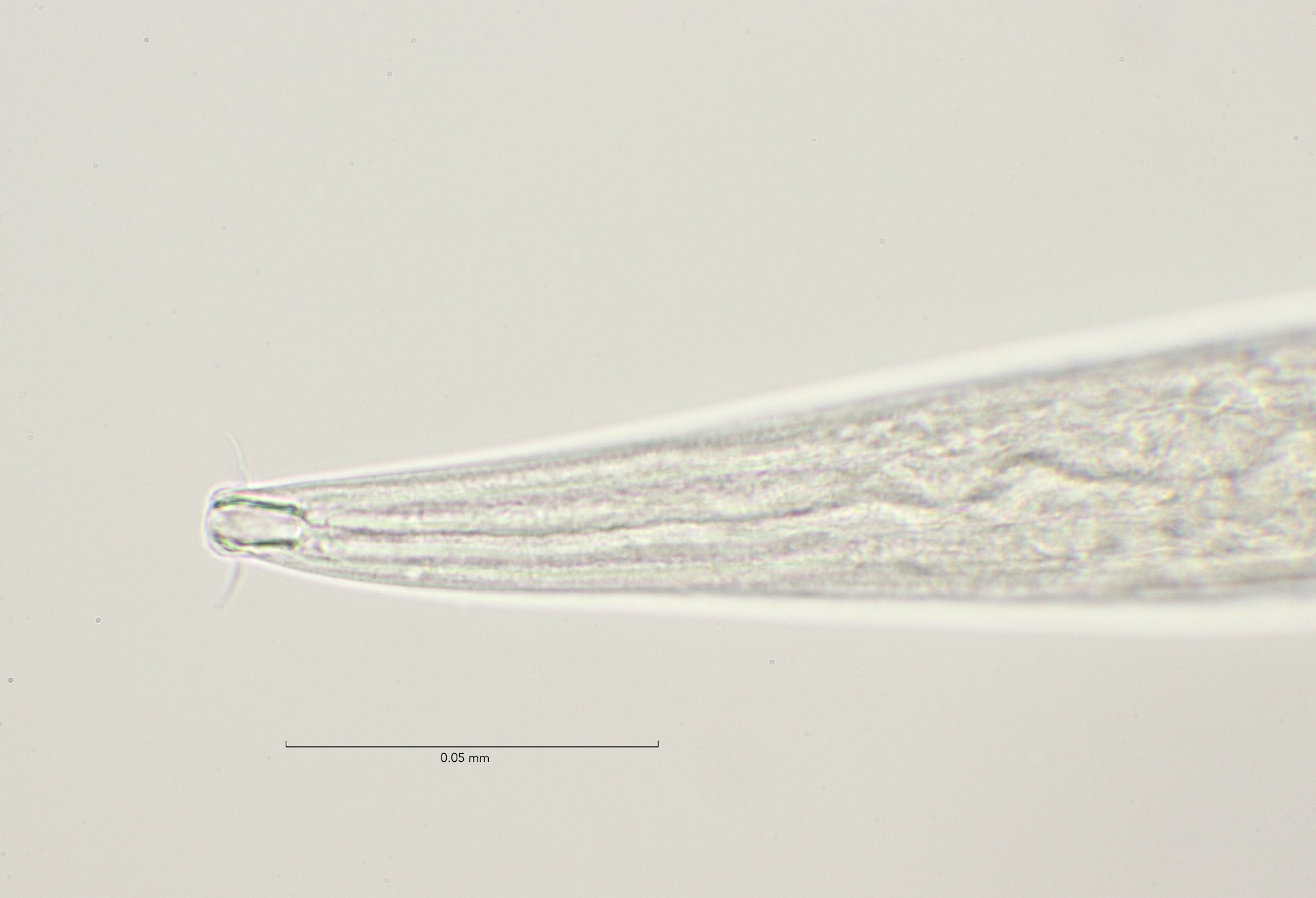 Anoplostoma viviparum, Slikken van Flakkee 9-4-2023 male head region 100x