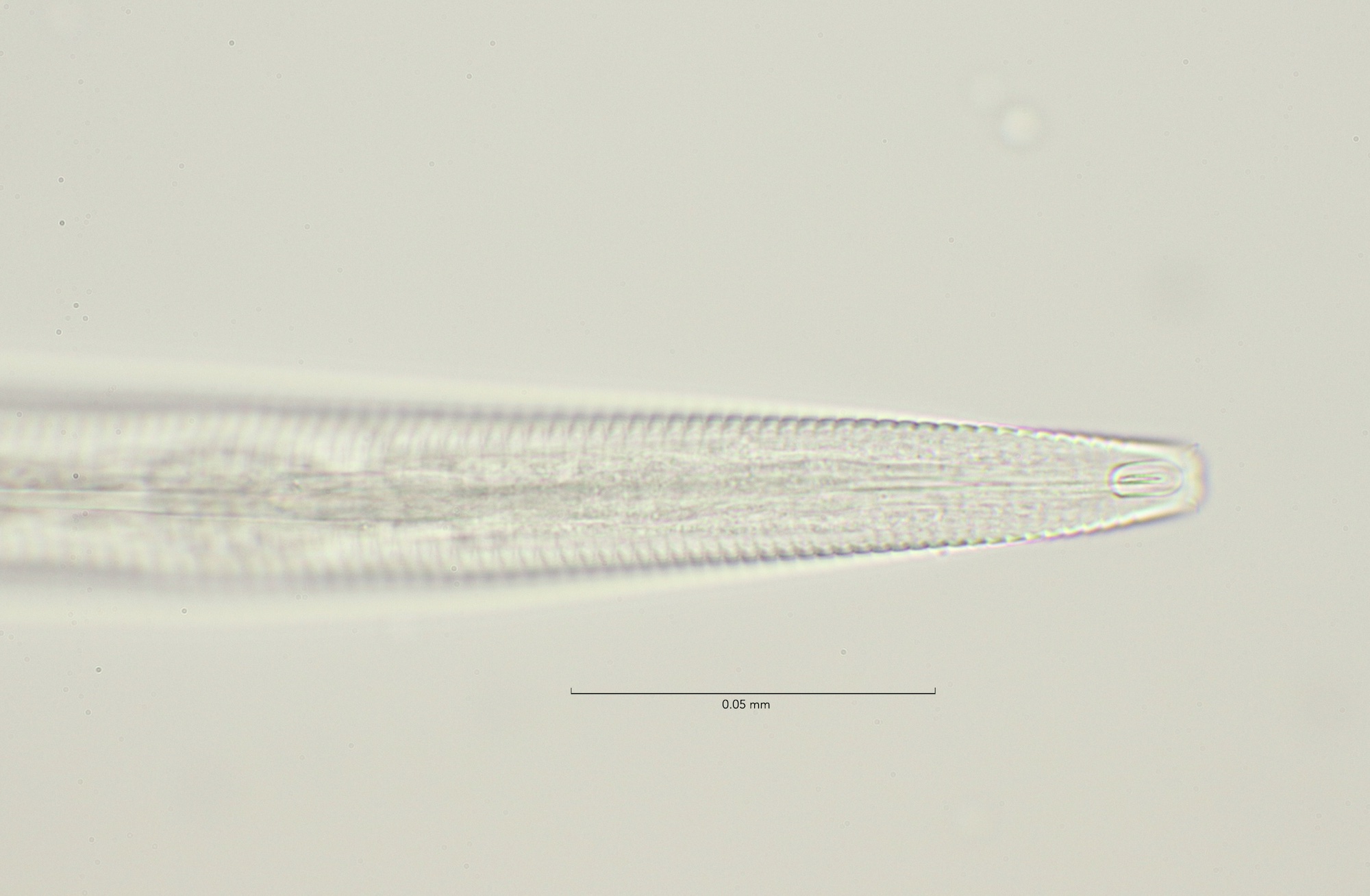 Antomicron elegans, Stellendam 23-1-2022, head region 100x