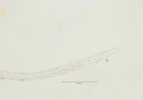 Axonolaimus demani, male head region, 40x