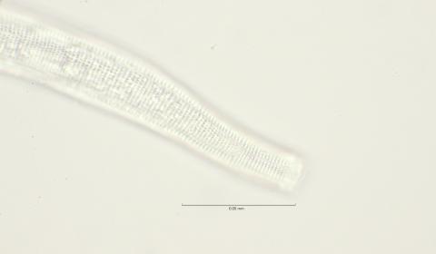 lateral field head, 100x