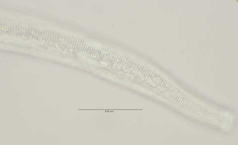 lateral field oesophagus region, 100x