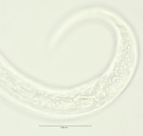 lateral field tail region, 100x