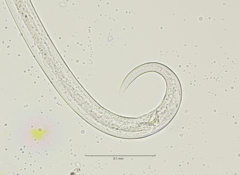 tail region, 40x, stack