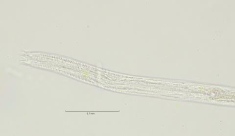 head region w amphid, 40x