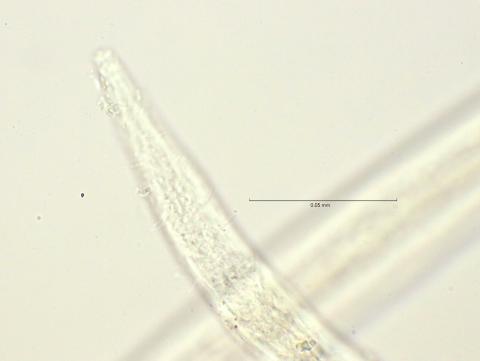 head region with cervical spines, 100x