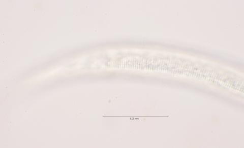 lateral field at cloaca region, 100x