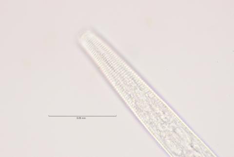 lateral field at head region, 100x