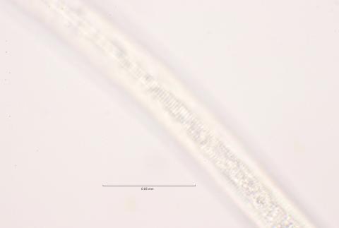 lateral field at mid body, 100x