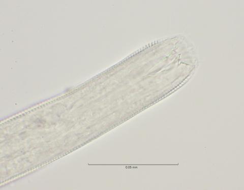 head region with dorsal tooth, 100x