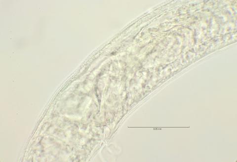 tail region with gubernaculum, 100x