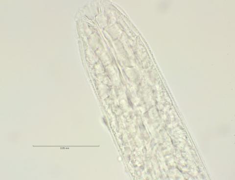 head region with dorsal tooth, 100x