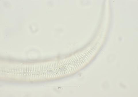 lateral field at cloaca region, 100x