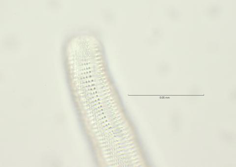 lateral field at head region, 100x