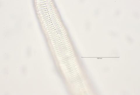 lateral field oesophagus region, 100x