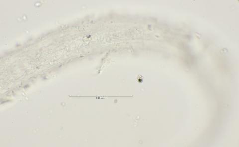 lateral field at cloaca region, 100x