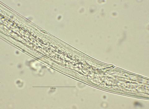 spicula and supplement, 100x