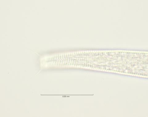 head with cephalic setae and amphid, 100x