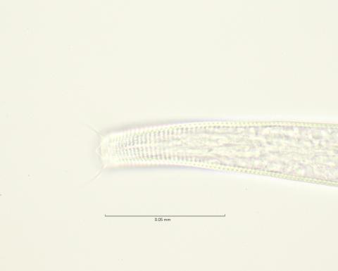 head with amphid and lateral field, 100x