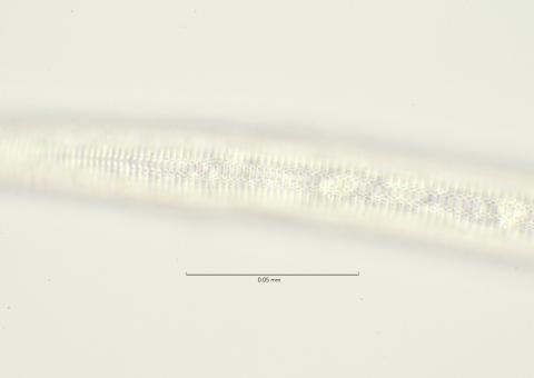 lateral field oesophagus end, 100x