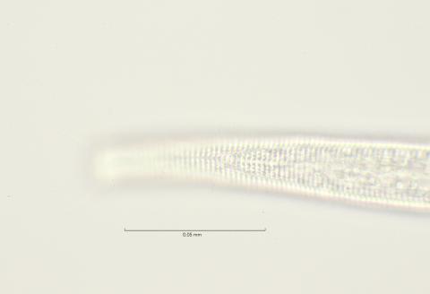 lateral field oesophagus region, 100x