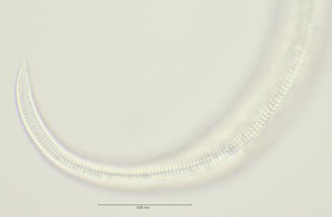 lateral field tail region, 100x