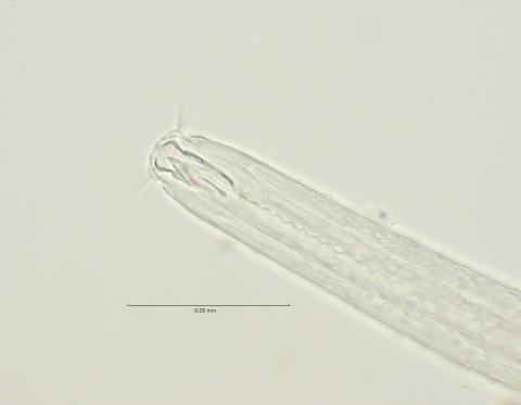 head with right subventral and dorsal tooth, 100x