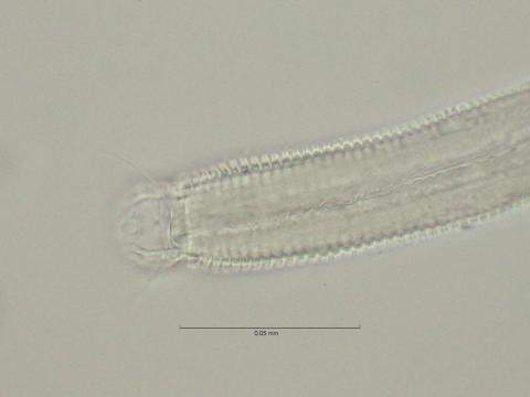 head region with cephalic setae, 100x