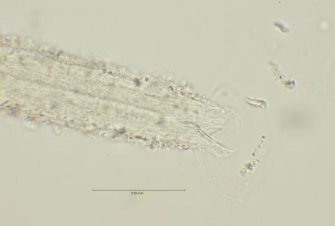 head region with cephalic setae, 100x