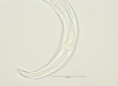 lateral field at cloaca, 100x