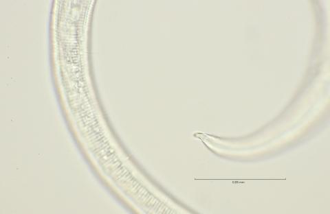 lateral field at mid body, 100x