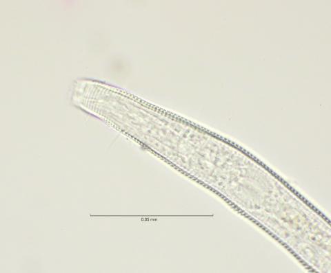 lateral field at head region, 100x